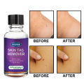 10ml/20ml/30ml/50ml Skin Tag Remover For Common And Plantar Warts Remove. 