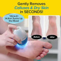 Electric Foot Pedicure Grinder Remover Tools Electric Automatic Polisher File Dead Skin Callus Feet Care Cleaning. 