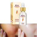 White Rice Serum for Face Glowing 15ml. 