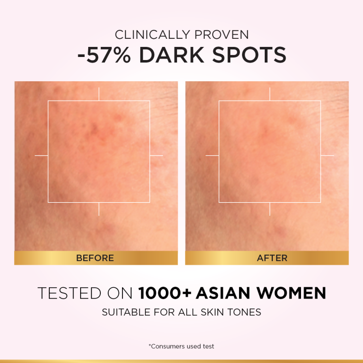 L'Oreal%20Paris%20Glycolic%20Bright%20Instant%20Glowing%20Serum,%20Reduces%2057%25%20Dark%20Spots,%2015ml%20-%20Anti-Dark,%20Spot%20Brightening%20Face%20Serum%20-%20Image%204