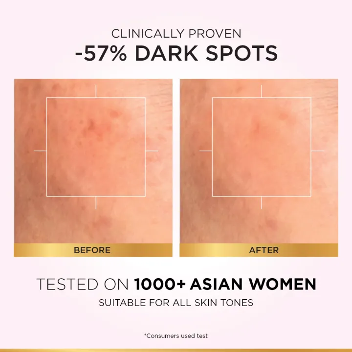 L'Oreal%20Paris%20Glycolic-Bright%20Glowing%20Daily%20Face%20Wash,%20For%20Even%20Glowing%20Skin,%20100ml%20-%20Brightening,%20Dark%20Spots,%20Glowing%20Skin%20-%20Image%204