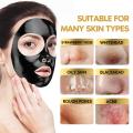 Lichen Blackhead Remover Mask, Peel Off Face Mask, Charcoal Face Mask for Black Head Remover, Skin Deep Cleansing for Face Nose Blackhead Pores Acne, Women & Men Face Skin Care - 100 ml. 