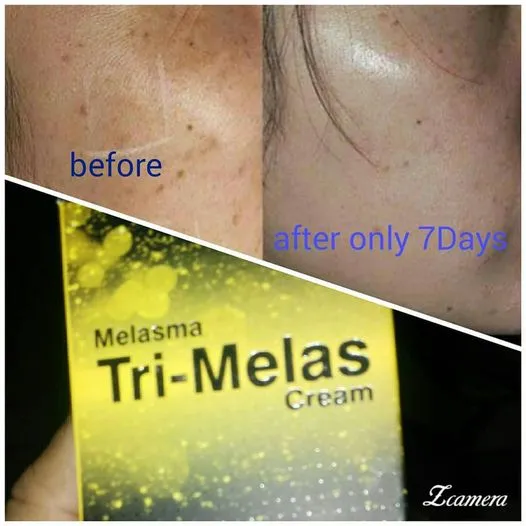 dr%20romia%20tri%20mels%20cream%20-%20Image%204