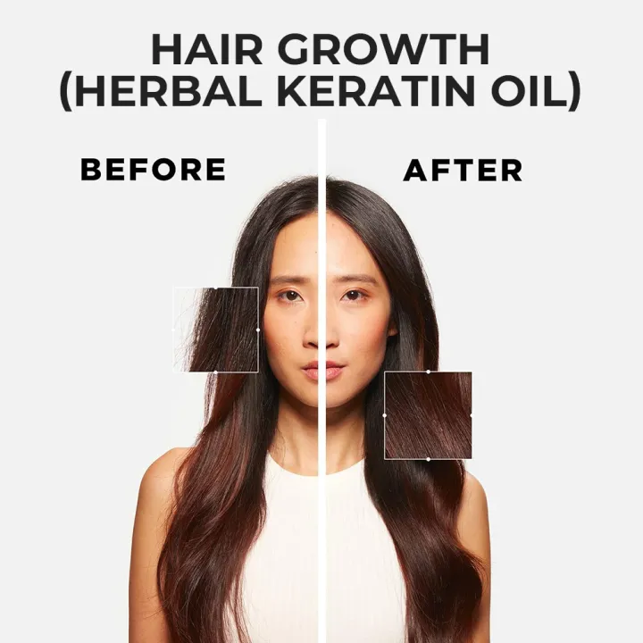 Organic%20Oasis%20Hair%20growth%20(Herbal%20keratin%20Oil)%20%7C%20powerful%20mix%20of%2060%25%20herbs%20and%20100%25%20natural%20oils%20for%20hair%20growth%20%7C%20130ml%20Bottle%20of%20hair%20oil%20%7C%20Organic%20Oasis%20Hair%20Oil%20For%20Men%20&%20Women%20-%20Image%205