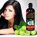 Bio Amla Shampoo Family Pack | Pack of 2 Bio Amla Shampoo | 720ml for Hair Fall Control. 