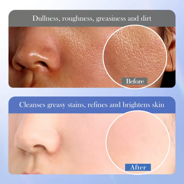 BIOAQUA%20Ceramide%20Salicylic%20Acid%20Facial%20Cleanser%20Deep%20Cleansing%20Oil%20Control%20Whitening%20Brightening%20&%20Moistening%20Face%20Wash%20Facial%20Wash%20Cleanser%20BQY34908%20-%20Image%206