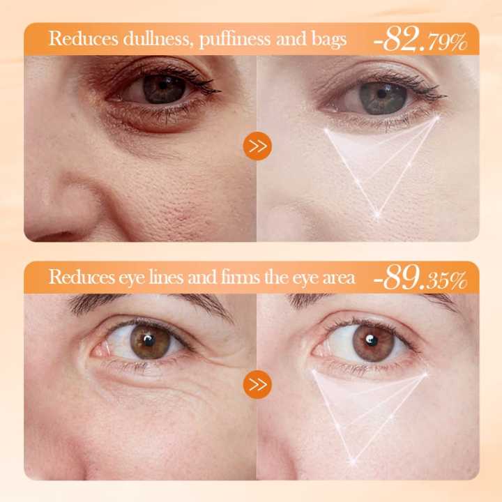 BIOAQUA%20Vitamin%20C%20Eye%20Cream%2020g%20%E2%80%93%20Whitening,%20Moisturizing,%20Repairing%20&%20Brightening%20Eye%20Serum%20for%20Dark%20Circles,%20Fine%20Lines%20&%20Puffiness,%20Nourishing%20Eye%20Care%20for%20All%20Skin%20Types,%20Exp%202028%20-%20Image%207