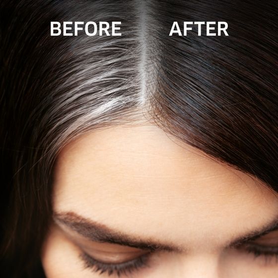 Wella%20Koleston%20Root%20Touch%20Up%203%20Medium%20to%20Dark%20Brown%20Spray%2075ml%20-%20Image%206