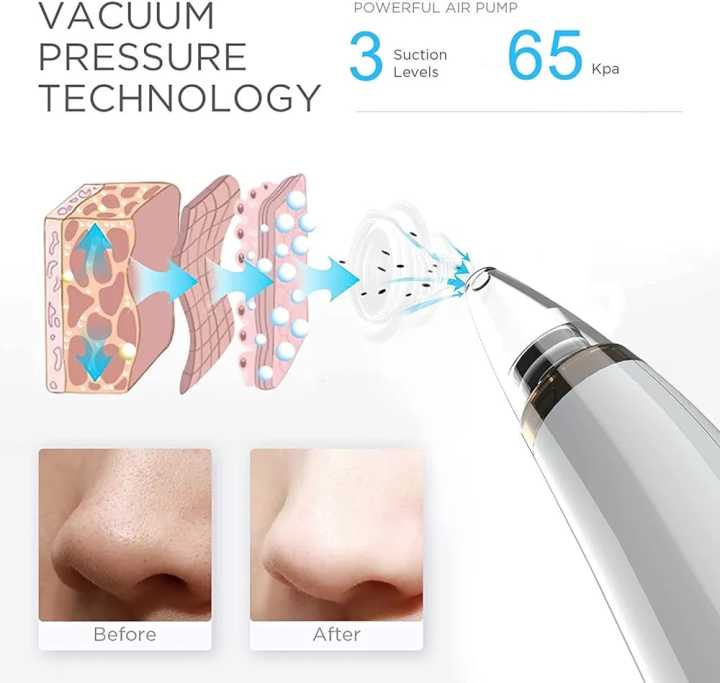 6-in-1%20Blackhead%20Remover%20USB%20Rechargeable%20%E2%80%93%20Derma%20Suction%20Acne%20&%20Blackhead%20Removal%20Machine%20with%20LED%20Display%20for%20Oily,%20Dry%20&%20Sensitive%20Skin%20-%20Image%203
