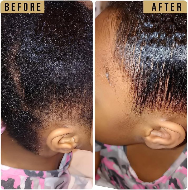 Ikt%20High-Quality%20Hair%20Styling%20Wax%20Stick,%20Non-Greasy%20Edge%20Control%20for%20Wigs%20&%20Curly%20Hair,%20Natural%20Ingredients,%202.7oz%20Single%20Pack%20-%20Image%209