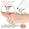 5 in 1 Electric Blackhead Acne Oil Remover Vacuum Suction Face Pore Cleaner Machine. 