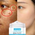 Whitening Freckle Face Cream Effective Remove Melasma Acne Spot Pigment Melanin Dark Spots Pigmentation Moisturizing Skin Care. 