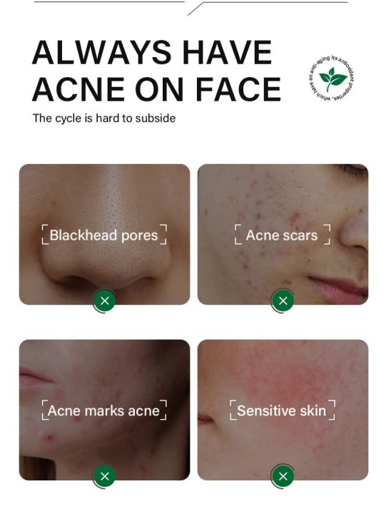 FORT Salicylic Acid Serum – Anti-Acne Face Serum & Dark Spot Correcting ...