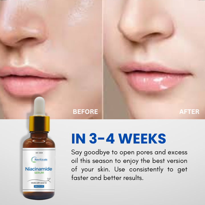 Reviticals%20Niacinamide%20Serum%20-%20Image%203