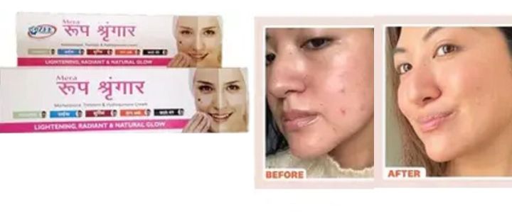 Mera Roop Shringar Acne Clear Cream 30g  (India)