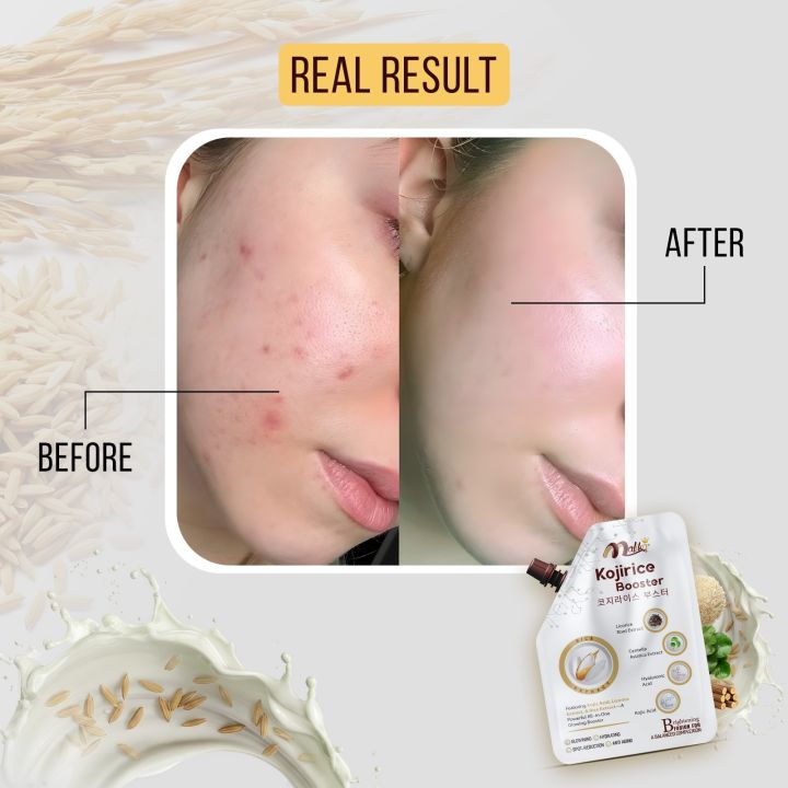 Kojirice%20Glowing%20Booster%20-%2050%20gm%20-%20Cream%20-%20Emulsion%20-%20Night%20Cream%20-%20Kojic%20Acid%20-%20Multi%20Functional%20Skin%20Enhancer%20-%20Beauty%20-%20Cream%20For%20Face%20Whitening%20-%20%20Beauty%20Cream%20-%20Keeps%20Skin%20(Hydrate,%20Glow,%20Bright)%20Skincare%20-%20Hand%20Cream%20-%20Kass%20Cosmetics%20-%20Image%203