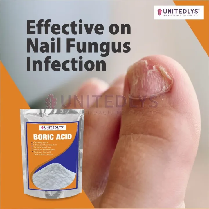 Multi-Purpose%20Boric%20Acid%20Powder%20for%20Cockroaches%20380%20Grams%20-%20Image%206