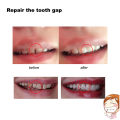 Dental Denture Temporary Restoration Solid Glue Tooth Repair Kit Oral Care Tool. 