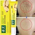 Whitening Cream Remove Melasma Freckles Fade Dark Spot Astragalus Remove Dark Yellow Skin Brighten Anti-aging Moisturize Skin. 