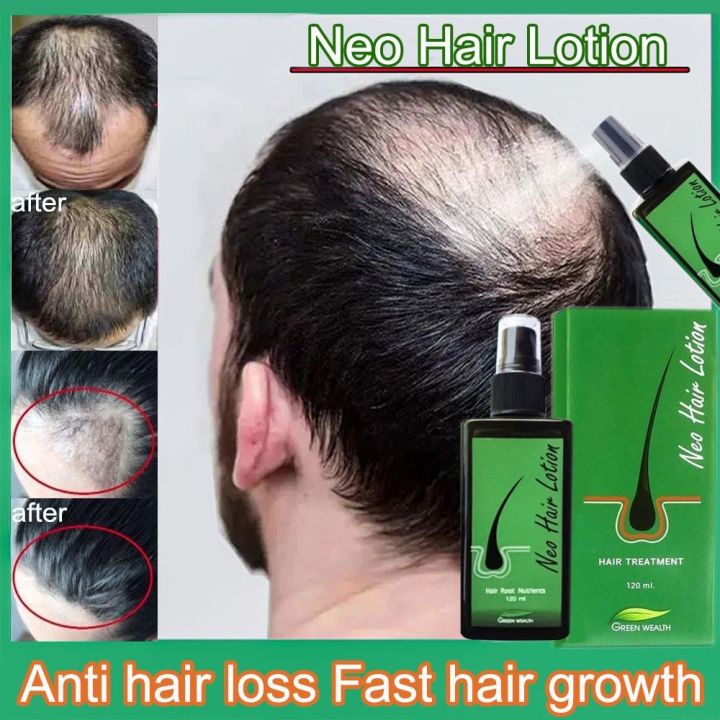 Neo%20Hair%20Lotion%20For%20Hair%20Growth%20Green%20Wealth%20-%20Image%204
