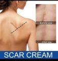 Scar Removal Cream Burn  Scar Treatment. 