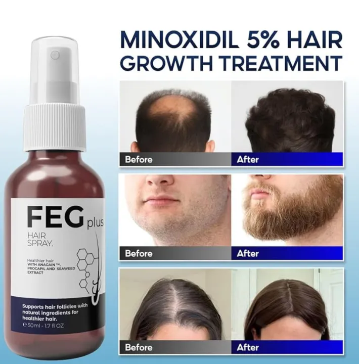 FEG%20PLUS%20Hair%20Growth%20Spray%20%E2%80%93%20Thicker,%20Healthier%20Hair%20Naturally!%20%20Clinically%20Proven%20%7C%20Unisex%20%7C%20Easy%20to%20Use%20-%20Image%202