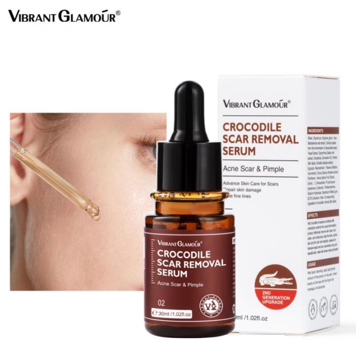 Crocodile Scar Repair Serum Pimples Stretch Marks Face Gel Remove Acne Smoothing Whitening Moisturizing Body Skin Care 30ML