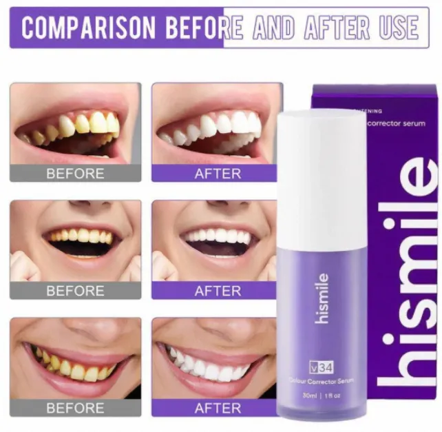 HiSmile%20V34%20Colour%20Corrector%20Serum%2030ml%20%E2%80%93%20Advanced%20Teeth%20Whitening%20and%20Brightening%20Formula%20-%20Image%204