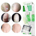 Skin Tag Removal Body Mole Wart Remover Spot Marks Wart Remover Beauty Tools professional design. 