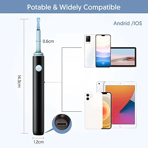Smart%20Visual%20Ear%20Wax%20Cleaning%20Kit%20with%20Camera%20HD%20%E2%80%93%20Wireless%20Ear%20Cleaner%20Endoscope%20%E2%80%93%20Rechargeable%20Earwax%20Removal%20Tool%20with%20Soft%20Silicone%20Tips%20-%20Rechargeable%20HD%20Ear%20Camera%20with%20Mobile%20Display%20-%20Image%206