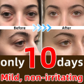 Killer Bzzo 7 Days Anti-Wrinkle Magic Eye Cream Remove Eye Bags Dark Circles Puffiness Lift Firm Smooth Skin Care Moisturizing Massage Serum. 