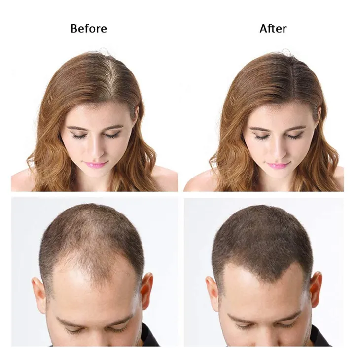 Hair%20Fiber%20Powder%20%E2%80%93%20Instant%20Hair%20Thickening%20Solution%20for%20Thinning%20&%20Fine%20Hair%20-%20Image%204