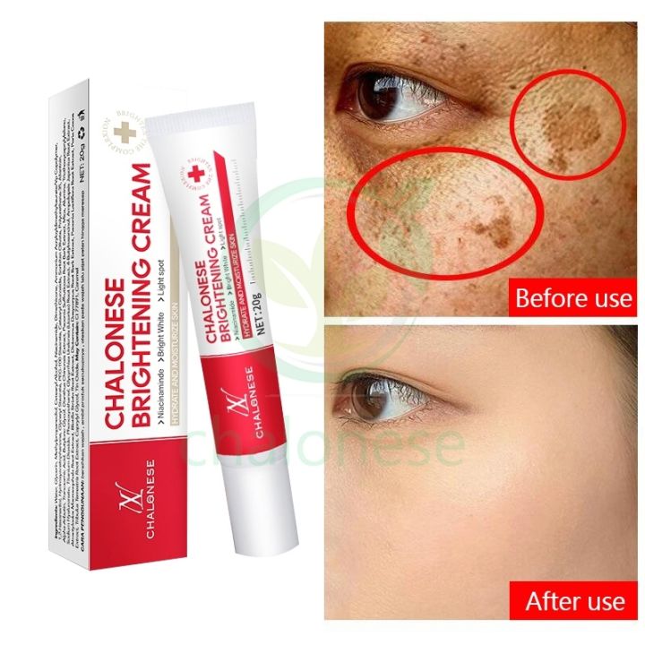 Chalonese%20brightening%20cream%20-%20Image%203