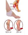Silicone Gel Heel Pad Socks for Pain Relief and anti crack heel 1 Pair. 