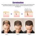 Derma Roller Professional Microneedling Roller for Face Beard Growth Hair Growth Mesotherapy System Beauty. 