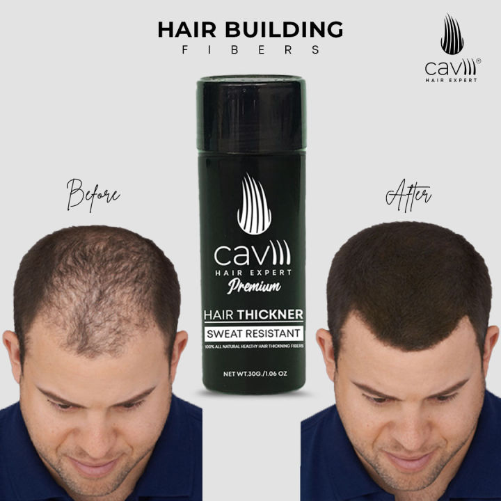 Caviii%20hair%20fibers%2030g%20combo%20offer%203in1%20better%20than%20toppik%20hair%20fibers%20-%20Image%205