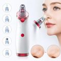 Microdermabrasion Blackhead Remover Vacuum Suction Face Pimple Acne Comedone Extractor Facial Pores Cleaner Skin Care ToolsWhite（White）. 