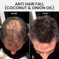 Anti Hair Fall Coconut & Onion Oil - Organic Oasis Hair Oil - Hair Growth oil - Anti Hair Loss & Hair Growth with Coconut Oil - 130 ml - Hair Care oil - Onion oil - Argan oil - Onion Extract oil for hair,. 