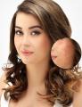 Derma Roller Hair & Skin Rejuvenation System. 