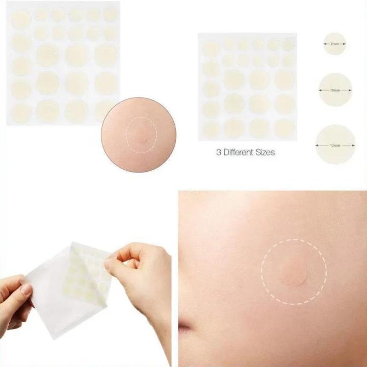 24pcs%20Face%20Acne%20Pimple%20Spot%20Facial%20Skin%20Care%20Blackhead%20Removal%20Freckle%20Patches%20Scar%20Care%20Treatment%20Stickers%20Acne%20Mask%20Beauty%20-%20Image%202