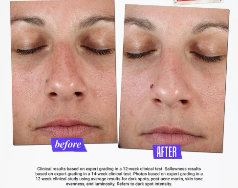 Kiehl's%20Clearly%20Corrective%20Dark%20Spot%20Solution%20%7C%2011.11%20Big%20Sale%20Discount%20%7C%20Brightening%20Vitamin%20C%20Serum%20(100ml%20Jumbo)%20-%20Image%205