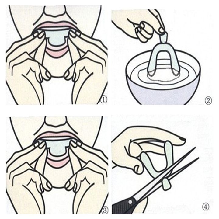 2pcs%20Silicone%20Mouth%20Guard%20Night%20Anti%20Snoring%20Bruxism%20Whitening%20Teeth%20Mouth%20Tray%20Sports%20Boxing%20Tooth%20Protector%20Sports%20Brace%20-%20Image%205