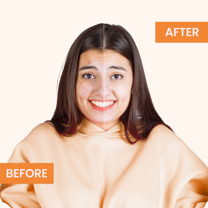 Face%20Fresh%20Vitamin-C%20Ampule%20(5ml)%20-%20Image%202