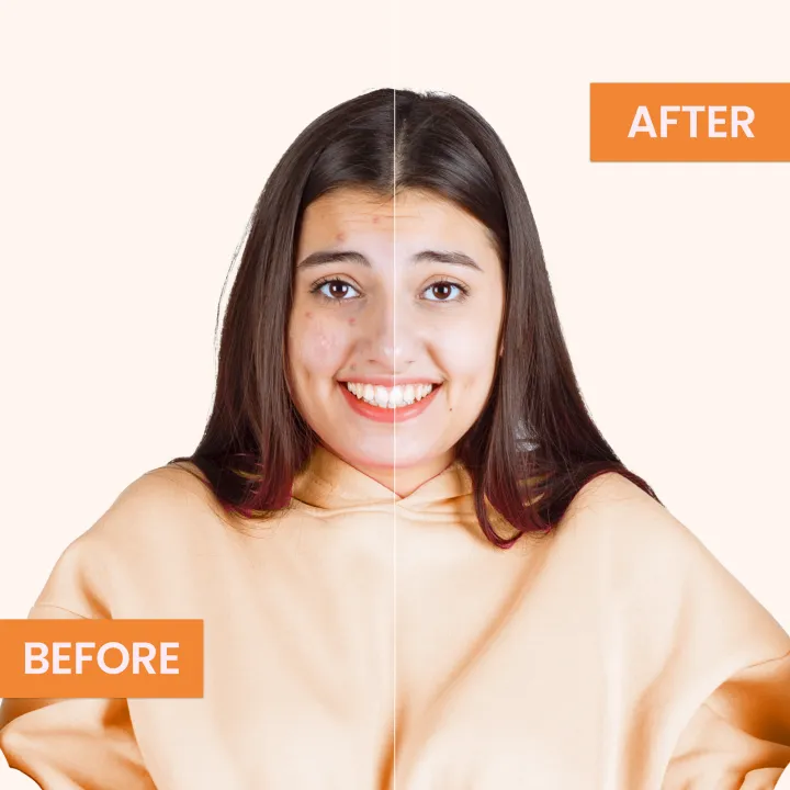 Face%20Fresh%20Vitamin-C%20Ampule%20(5ml)%20-%20Image%202