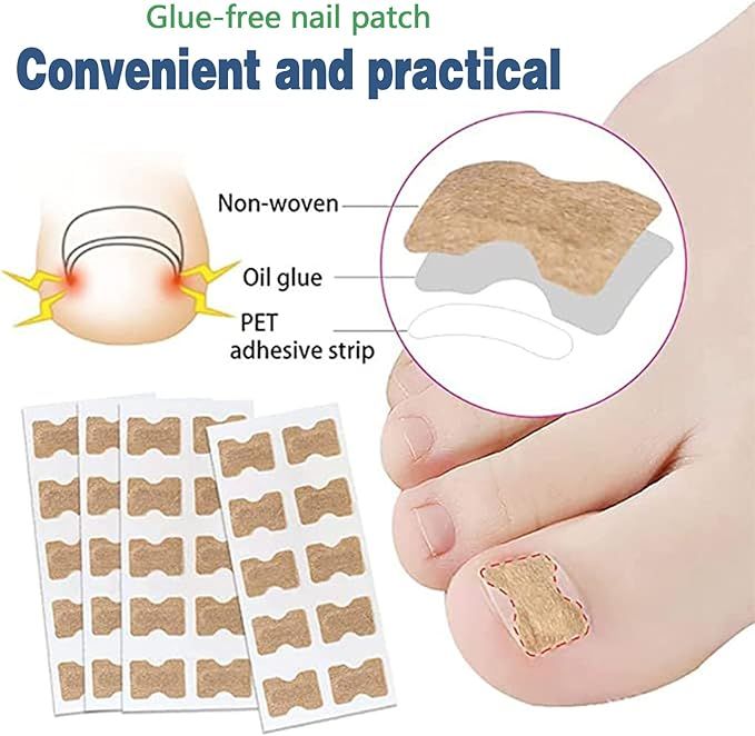 Royal%20Prestige%20Ingrown%20Toenail%20Pain%20Reliever%20Patches%20(30%20Patches)%20%E2%80%94%20Fast%20Relief,%20Toenail%20Correction%20Sticker,%20Toe%20Nail%20Treatment%20Strips%20ingrown%20toenail%20patches%20toenail%20pain%20reliever%20toenail%20correction%20sticker%20toe%20nail%20treatment%20foot%20care%20patch%20-%20Image%203