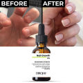 Nail Growth Serum 12% – Strengthening & Nourishing Formula with Biotin, Vitamin E & Keratin | 30ml. 