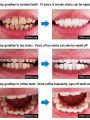 Teeth Whitening Essence Cleaning Teeth Tea Stains Toothwash Oral Care. 