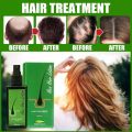 Neo Hair Lotion For Hair Growth Green Wealth. 