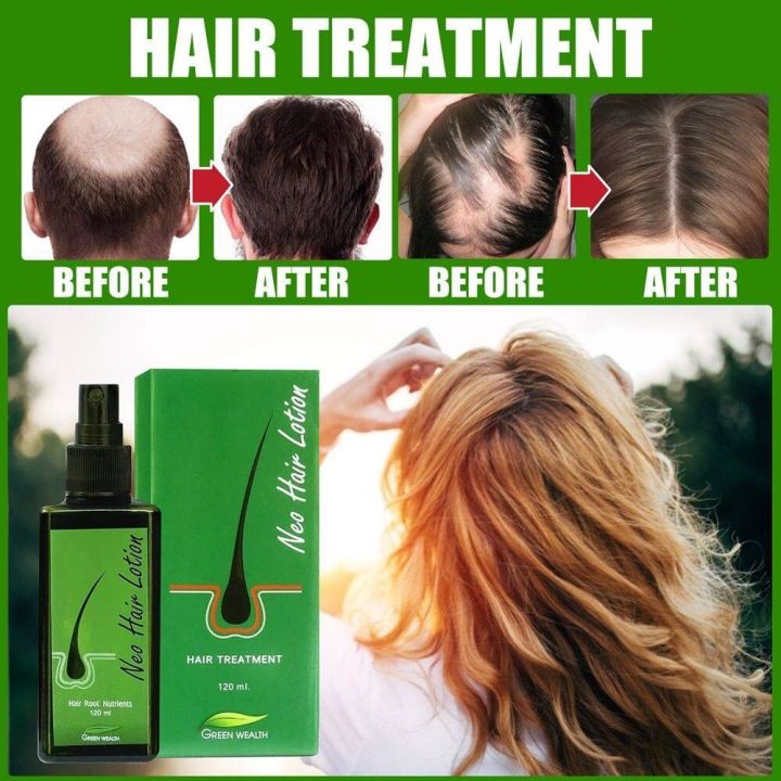 Neo%20Hair%20Lotion%20For%20Hair%20Growth%20Green%20Wealth%20-%20Image%205