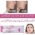 Acdermin Gel 20g – Targeted Acne Treatment. 